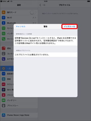 「インストール」を選択